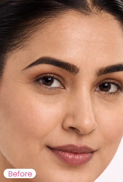 Close-up of a woman's face with a 'Before' label in the bottom-left corner