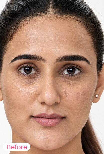 Before photo showing a woman's face prior to skincare treatment.
